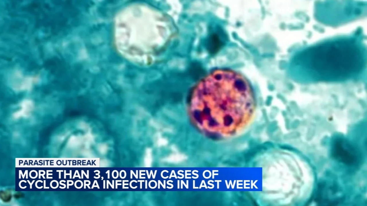 FDA finds potential source of cyclosporiasis outbreak linked to lettuce
