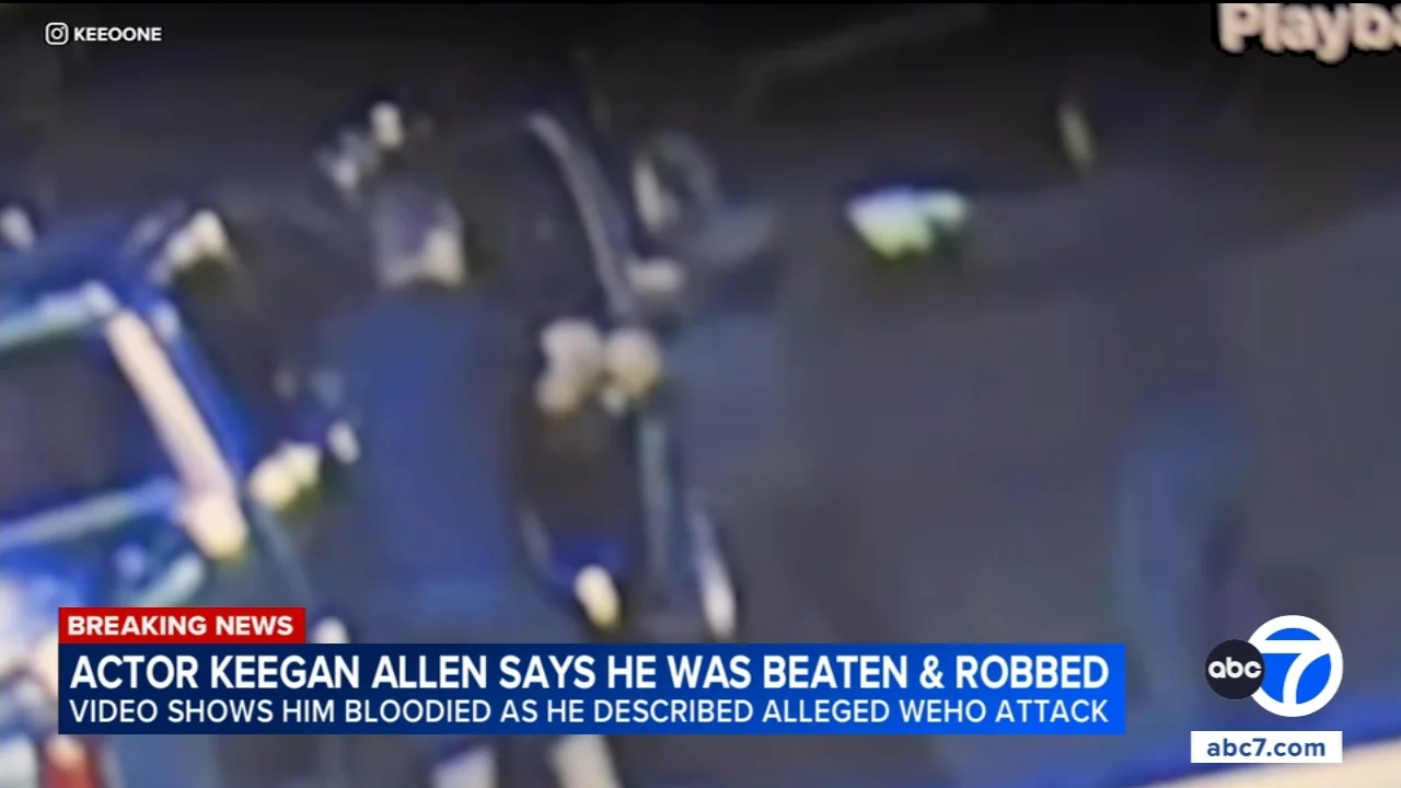 'Pretty Little Liars' actor Keegan Allen says he was beaten and robbed in West Hollywood