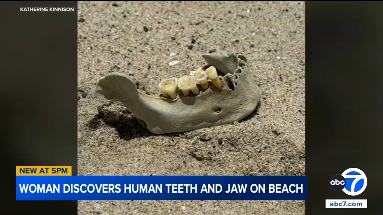 Woman finds human jawbone with teeth on San Clemente beach