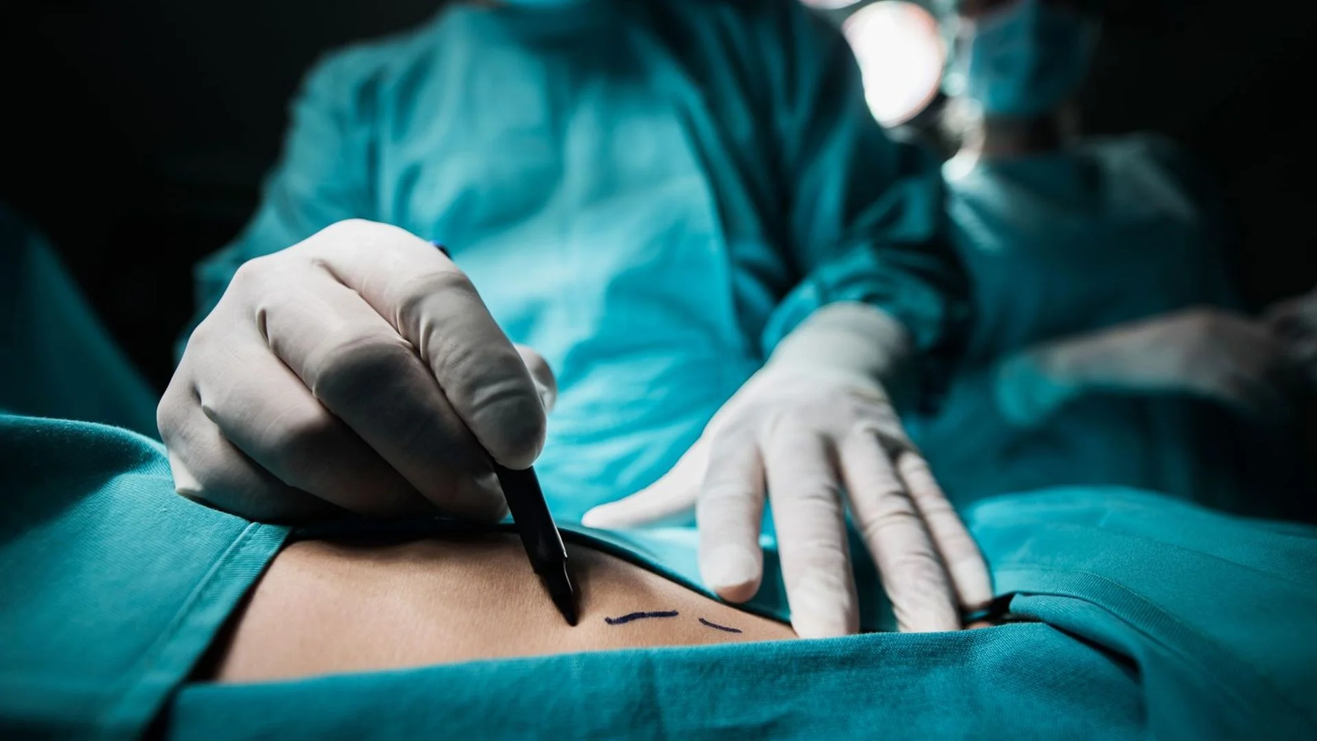 'Cosmetic cowboys' to face fines if they carry out risky procedures