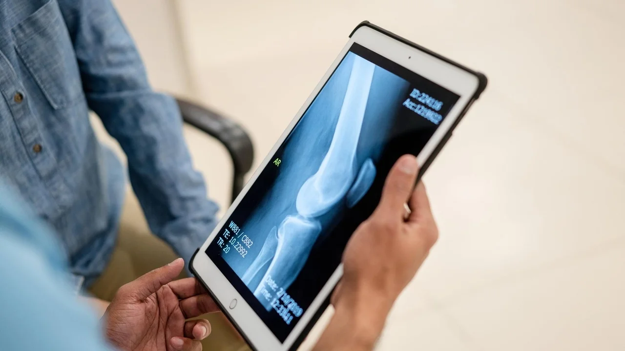As more patients access health records online, many come away confused, scared or misinformed, exper