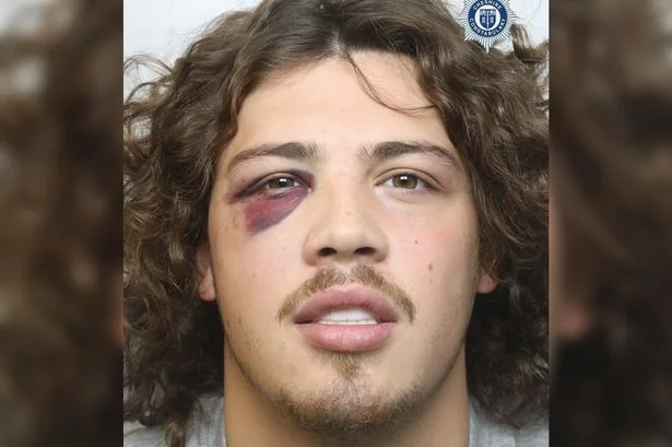 Skelmersdale man, 21, with black eye is jailed after being spotted swallowing mobile phone