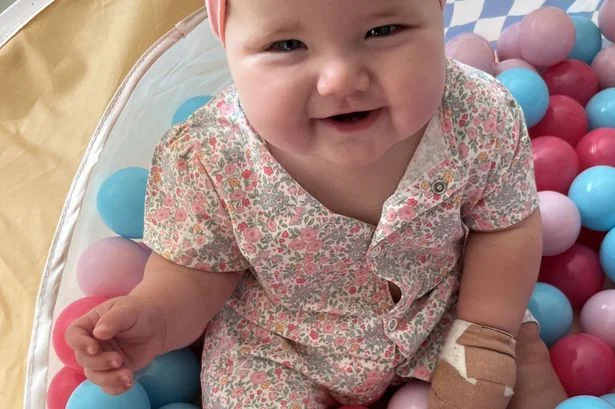 Baby rushed to Alder Hey after putting hand in gravy left in front of her at pub